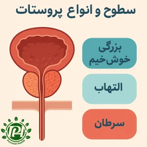 سطوح مختلف بیماری پروستات